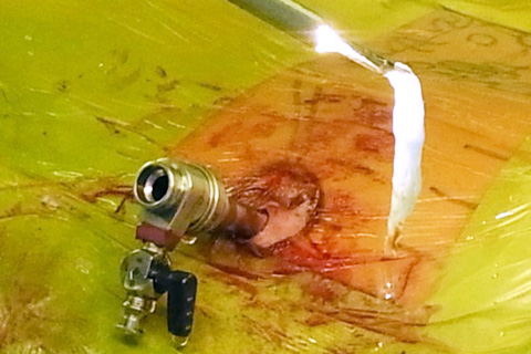 札幌 脊椎 内 視 鏡 整形 外科 クリニック